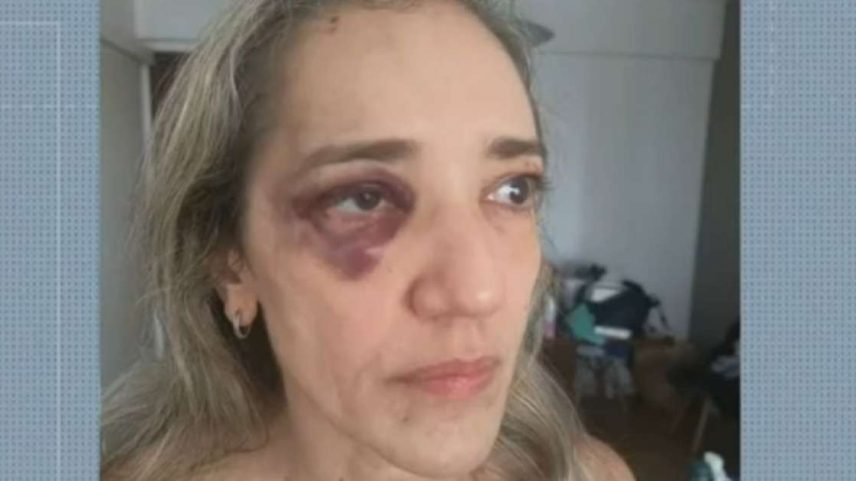 Ana Cristina Durão Nunes foi agredida por motociclista de aplicativo