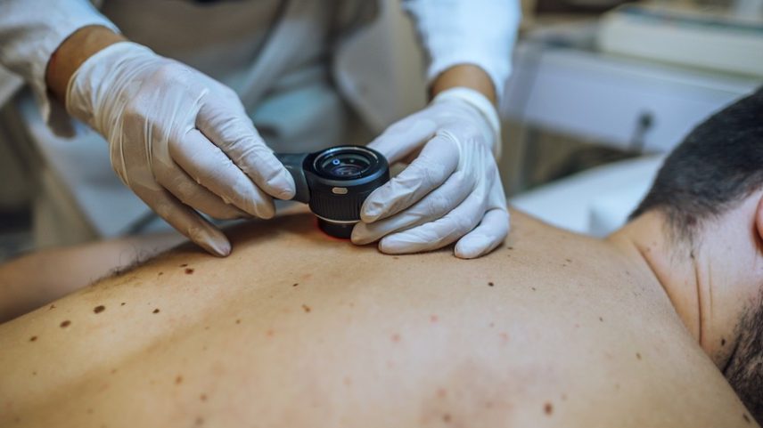 O câncer de pele não melanoma é o tipo de câncer mais incidente no Brasil