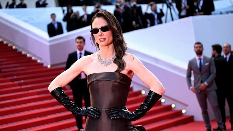 Coco Rocha — Foto: Getty Images