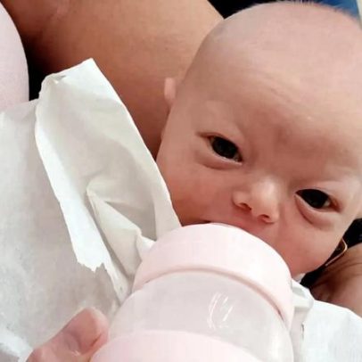 Menina de 2 anos é a única no mundo com condição ultrarrara sem nome