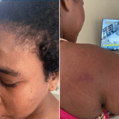 Grávida de seis meses é agredida por patroa no Maranhão
