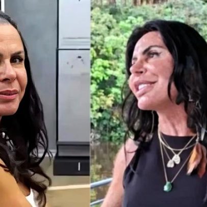 Gretchen revela drama com queda de cabelo e faz apelo às mulheres