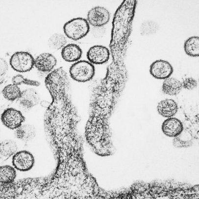 Hantavírus é altamente contagioso no início da doença, diz OMS
