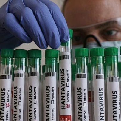 Infectologista explica chances de surtos virarem pandemia