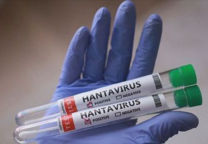 Especialistas buscam normas para conter surto de hantavírus