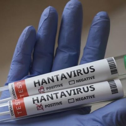 Hantavírus no Brasil: riscos e formas de prevenção
