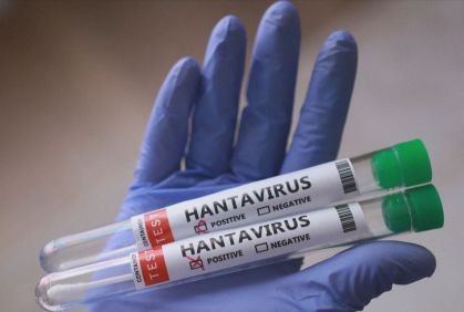 Tubos de ensaio com amostrar do hantavírus, que atingiu um cruzeiro de luxo