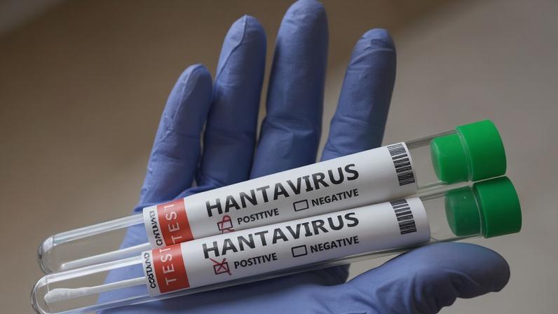 Tubos de ensaio com amostrar do hantavírus, que atingiu um cruzeiro de luxo