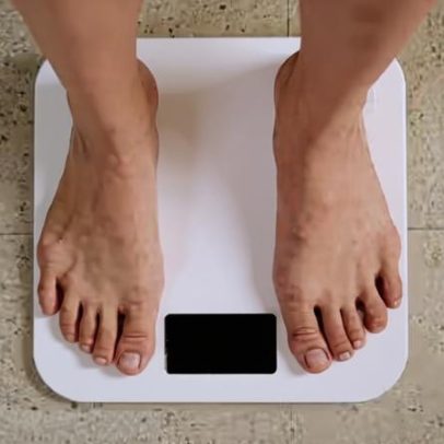 Como as células guardam memória da obesidade, aponta estudo