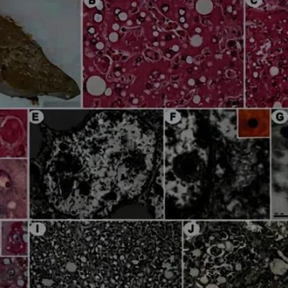 Vírus Sabiá circula no Brasil há 142 anos e pode causar morte