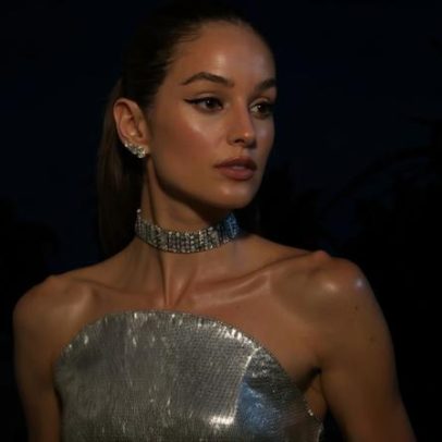 Mudança drástica em Izabel Goulart com Ponytail Lift gera debate sobre técnica