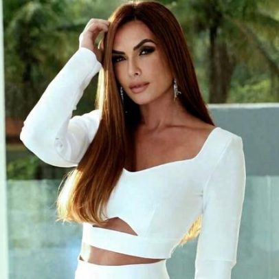 Nicole Bahls revela alopecia e passa por transplante capilar