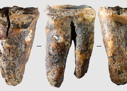 Neandertais usavam ferramentas de pedra para tratar cáries há 60 mil anos