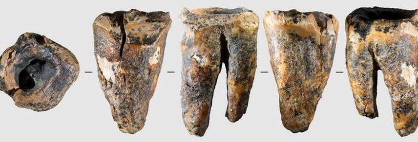 Vistas de ângulos diferentes de molar de 59 mil anos encontrado em caverna arqueológica da Sibéria