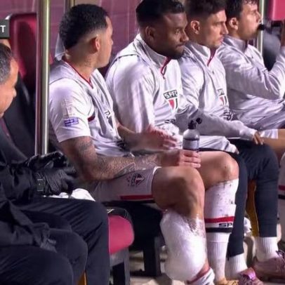 Luciano e Sabino sofrem dores e deixam jogo no 1º tempo contra Botafogo