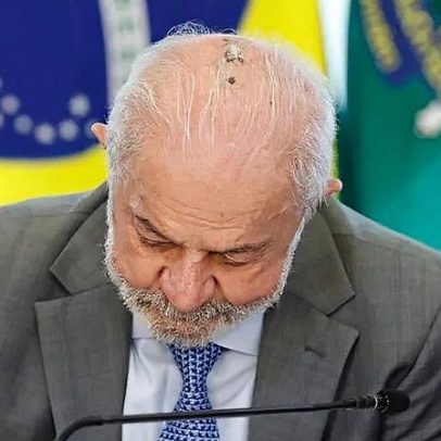 Lula faz exames em SP e evolução pós-tratamento é satisfatória