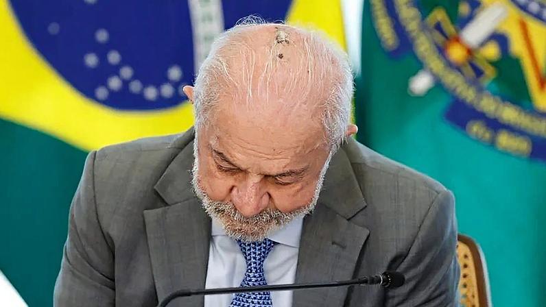 Presidente tratou lesão no couro cabeludo e tendinite no polegar