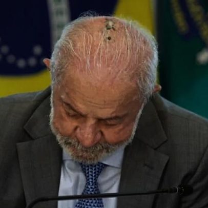 Lula mostra cicatriz durante tratamento de radioterapia