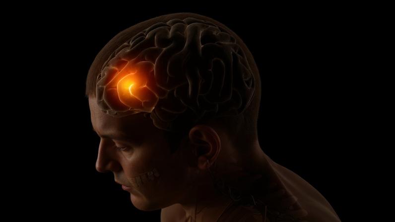 Renderização 3D de uma figura médica masculina com a parte frontal do cérebro em destaque - avc pode ser evitado