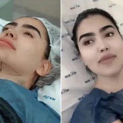 MC Mirella faz cinco cirurgias de uma vez após se tornar mãe