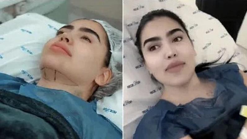 MC Mirella faz 5 cirurgias de uma vez após ser mãe