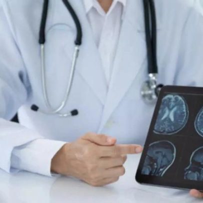 Especialista alerta para sintomas da esclerose múltipla que passam despercebidos