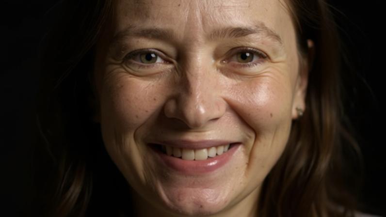Mulheres estão mais suscetíveis ao diagnóstico de melasma