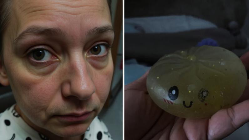 Menina sofre queimaduras após fazer trend do TikTok