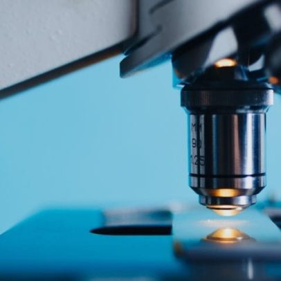 Estudo aponta padrão imune comum em Alzheimer, Parkinson e esclerose