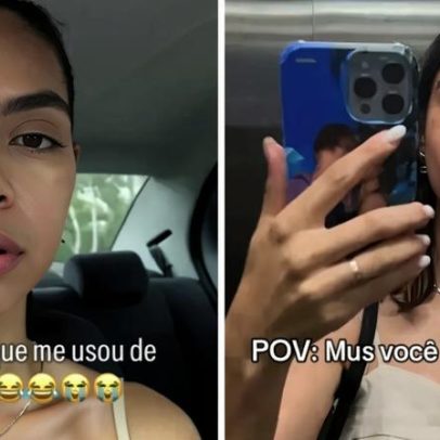 Modelo de Santa Catarina fica irreconhecível após remover preenchimento labial