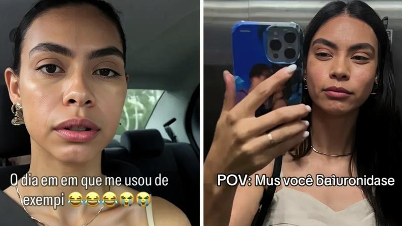 Modelo de SC fica irreconhecível ao remover preenchimento labial - Metrópoles