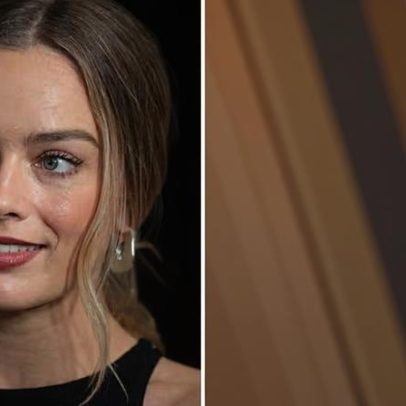 Cirurgião plástico explica procedimentos que alteraram o rosto de Margot Robbie