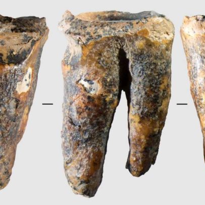 Neandertais faziam tratamentos dentários há 59 mil anos
