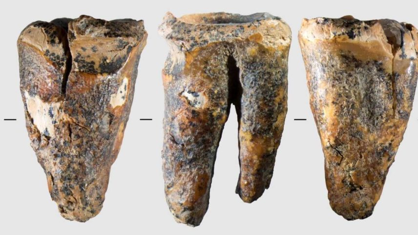 Pesquisas já sabiam que neandertais tratavam os dentes, mas operações desse nível ainda não haviam sido registradas