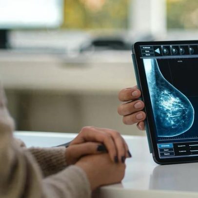 Medicamentos para diabetes e obesidade podem reduzir risco de câncer de mama