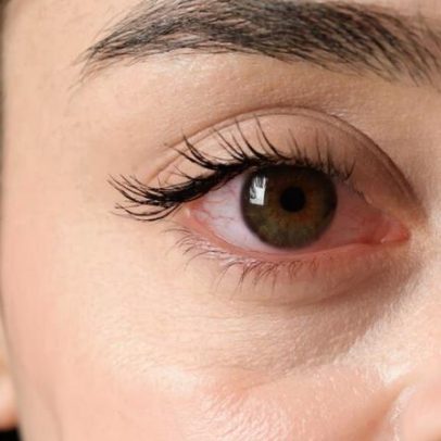 Visão embaçada? Alimentação pode proteger a saúde ocular