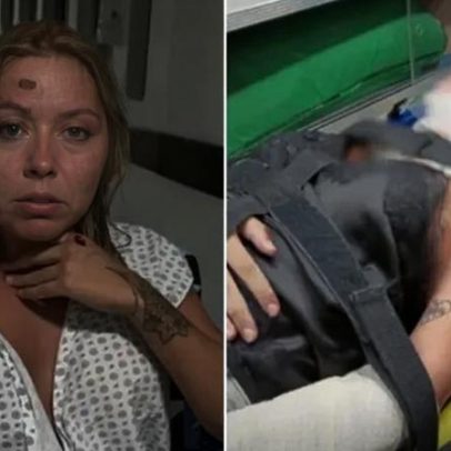 Passageira afirma ter sido atropelada após discussão com motorista de app