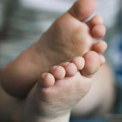Pé diabético: riscos e prevenção das complicações