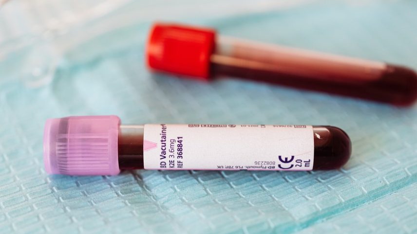 Análise de sangue pode revelar sinais biológicos da depressão antes mesmo do aparecimento de sintomas evidentes — Foto: Pexels/Karolina Grabowska