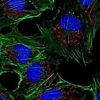 Nova variante genética explica doença neurológica rara na infância