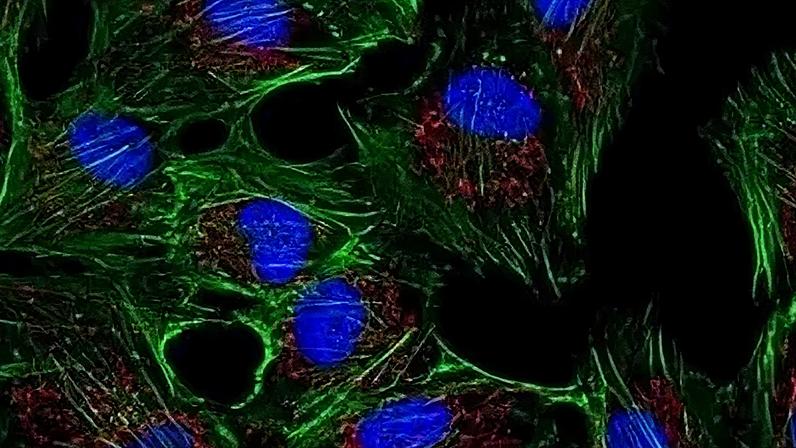 A proteína ARH3 remove sinais químicos temporários que, quando acumulados, podem prejudicar os neurônios