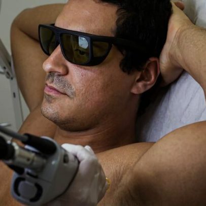 Depilação masculina: 6 mitos e verdades antes de iniciar o tratamento