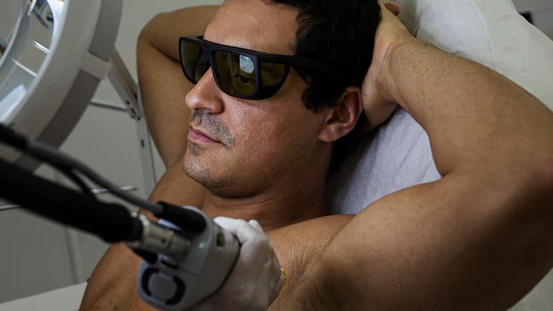 Depilação em homens: 6 mitos e verdades antes de começar o tratamento
