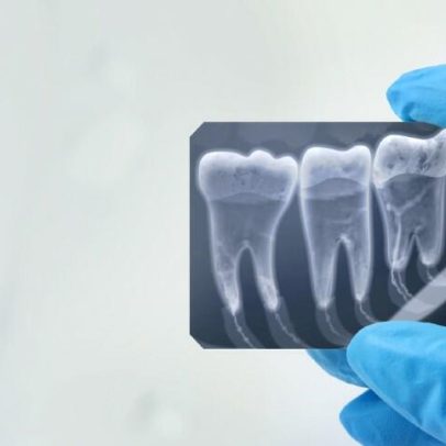 IA para dentistas atrai Triaxis, Crescera e cofundador da Odontoprev