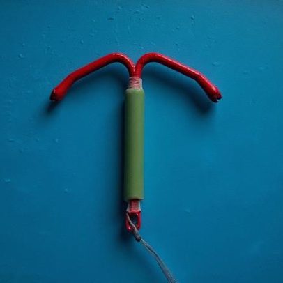 Mais da metade das mulheres sente dor intensa ao colocar DIU, aponta estudo