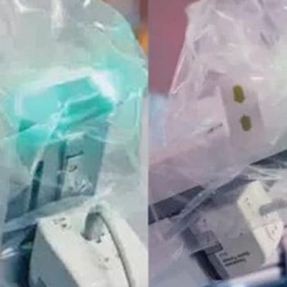 Cirurgia robótica: médico brasileiro na China opera paciente no RS