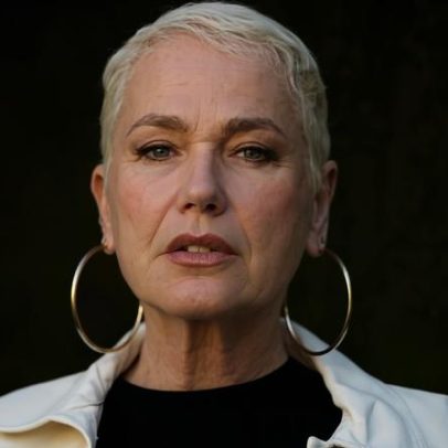 Diagnóstico de doença levou Xuxa a fazer transplante capilar, entenda