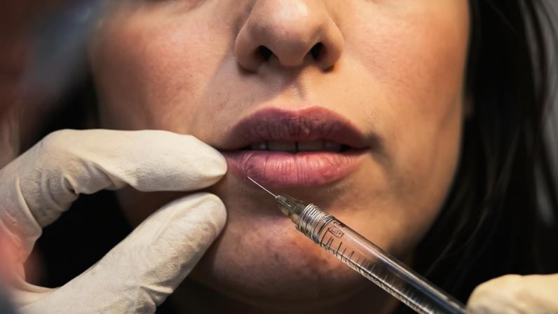 Preenchimento facial