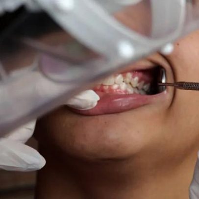 Gengiva sangrando: Dr. Kalil e especialistas detalham sinais de alerta