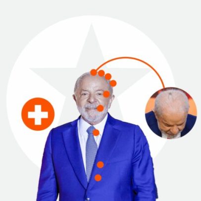 Lula faz 4ª aplicação de radioterapia preventiva